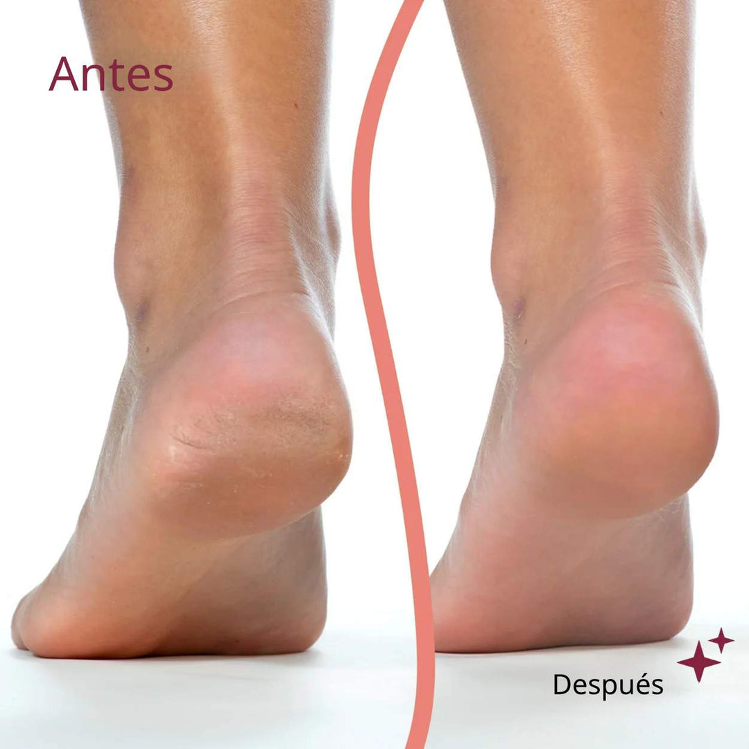 Dispositivo de pedicura eléctrico™ | ¡Piel suave al instante!