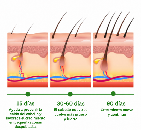 🌿 Aceite de Romero™ | Ayuda a fortalecer y revitalizar tu cabello