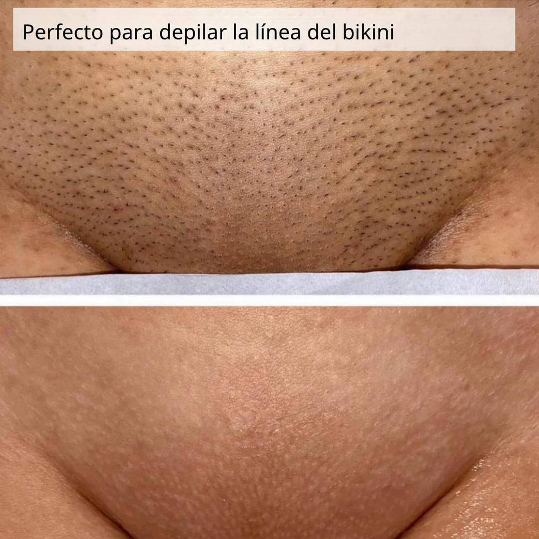 BeautyGleit Pro™ | ¡Crea suavidad!