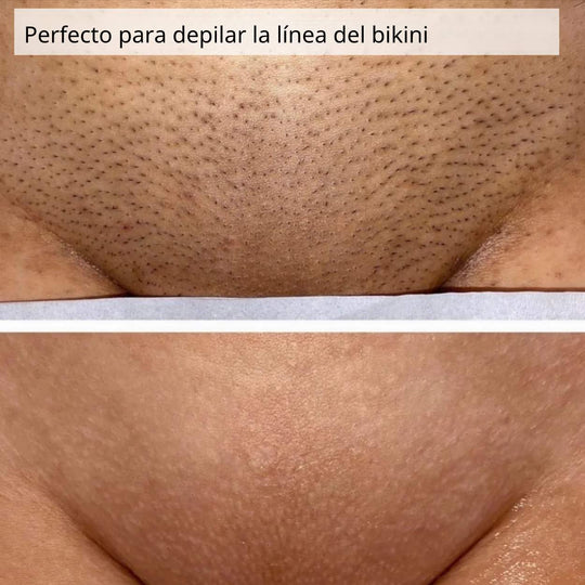 BeautyGleit Pro™ | ¡Crea suavidad!