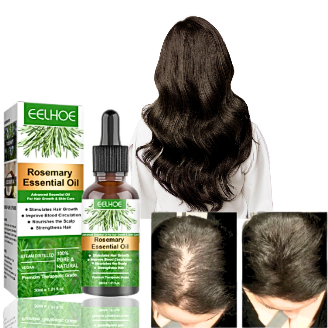 Aceite de Romero™ | Crecimiento del Cabello