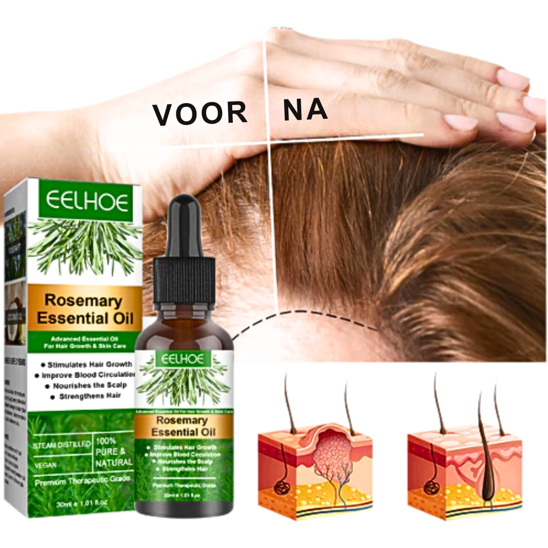 Aceite de Romero™ | Crecimiento del Cabello