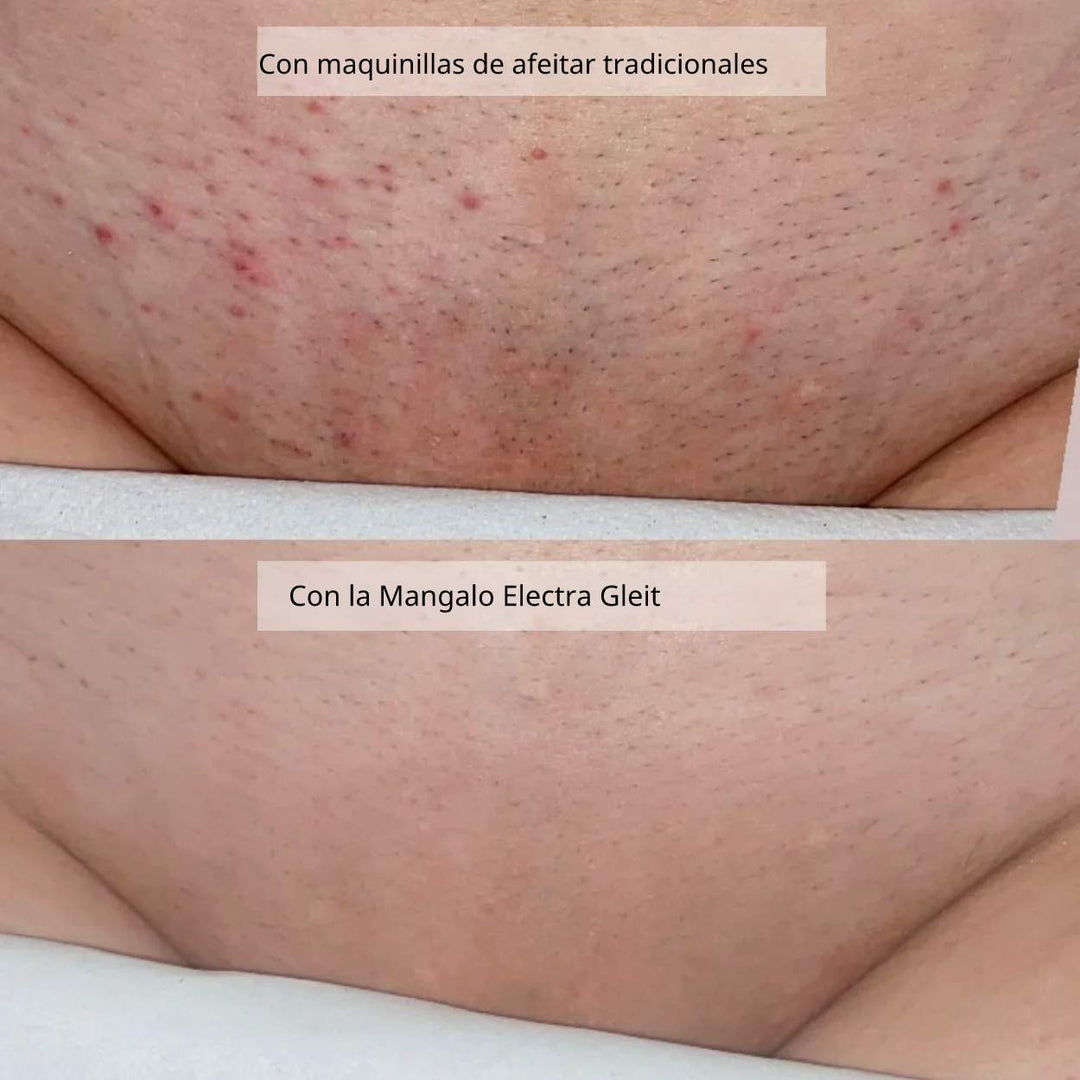 Mangalo Electra Gleit® | Afeitadora Todo-en-Uno para Damas