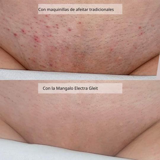Mangalo Electra Gleit® | Afeitadora Todo-en-Uno para Damas