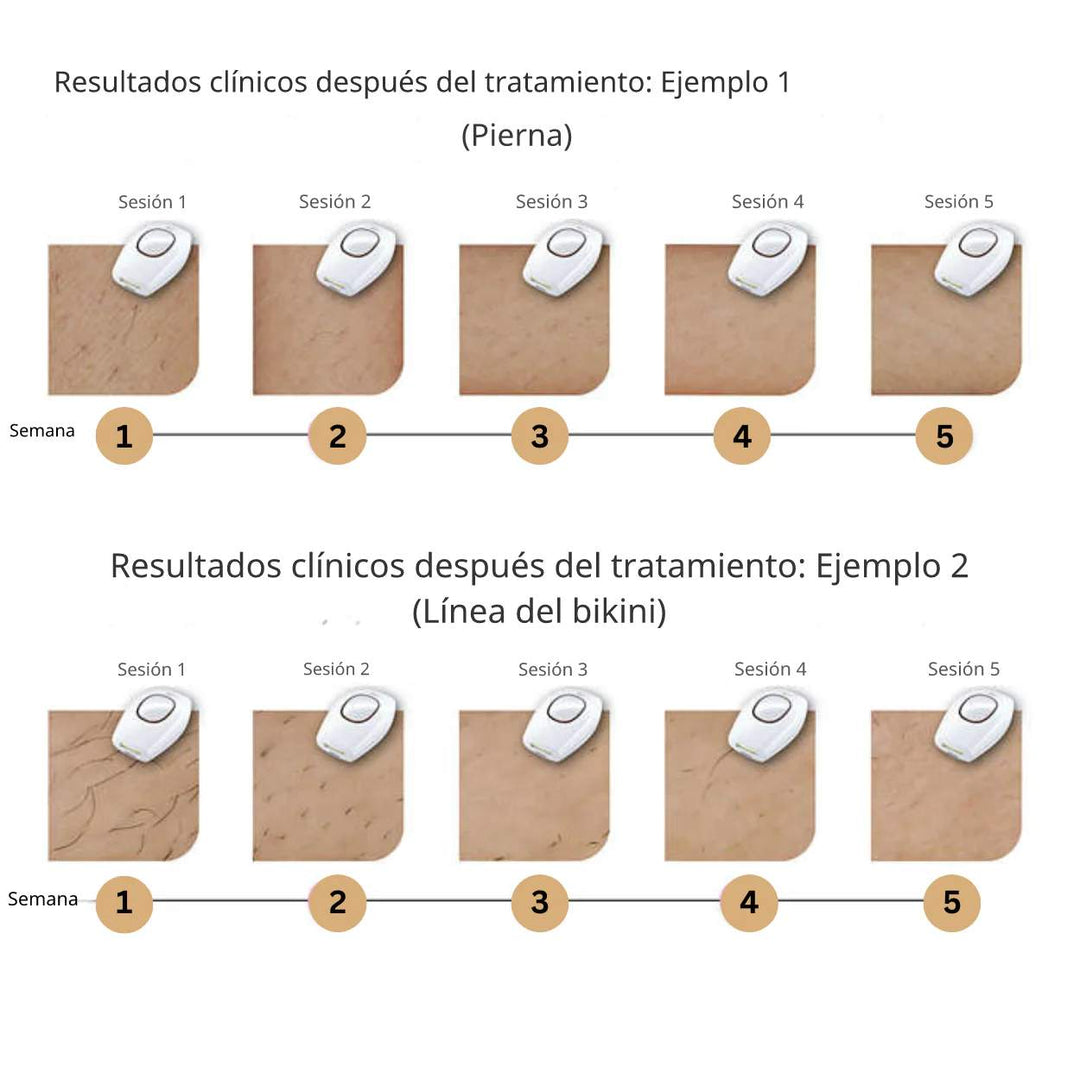 GlowFree™ | Piel sin vello con facilidad con el depilador láser IP