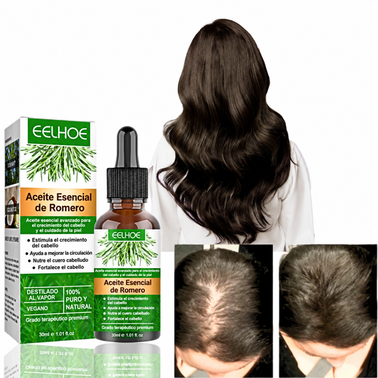 🌿 Aceite de Romero™ | Ayuda a fortalecer y revitalizar tu cabello