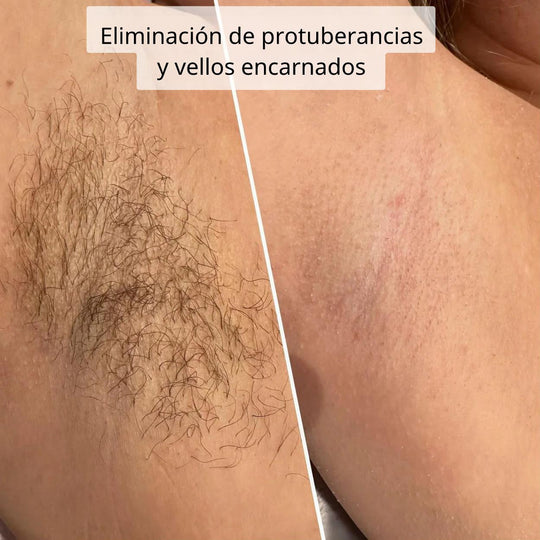 BeautyGleit Pro™ | ¡Crea suavidad!