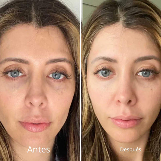 Gafas de terapia de luz roja™ | ¡Reduce las ojeras y rejuvenece!