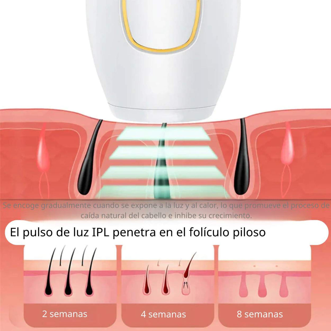 GlowFree™ | Piel sin vello con facilidad con el depilador láser IP