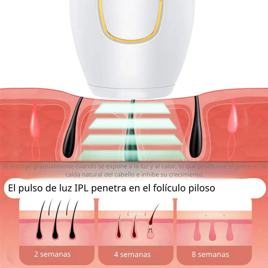 GlowFree™ | Piel sin vello con facilidad con el depilador láser IP