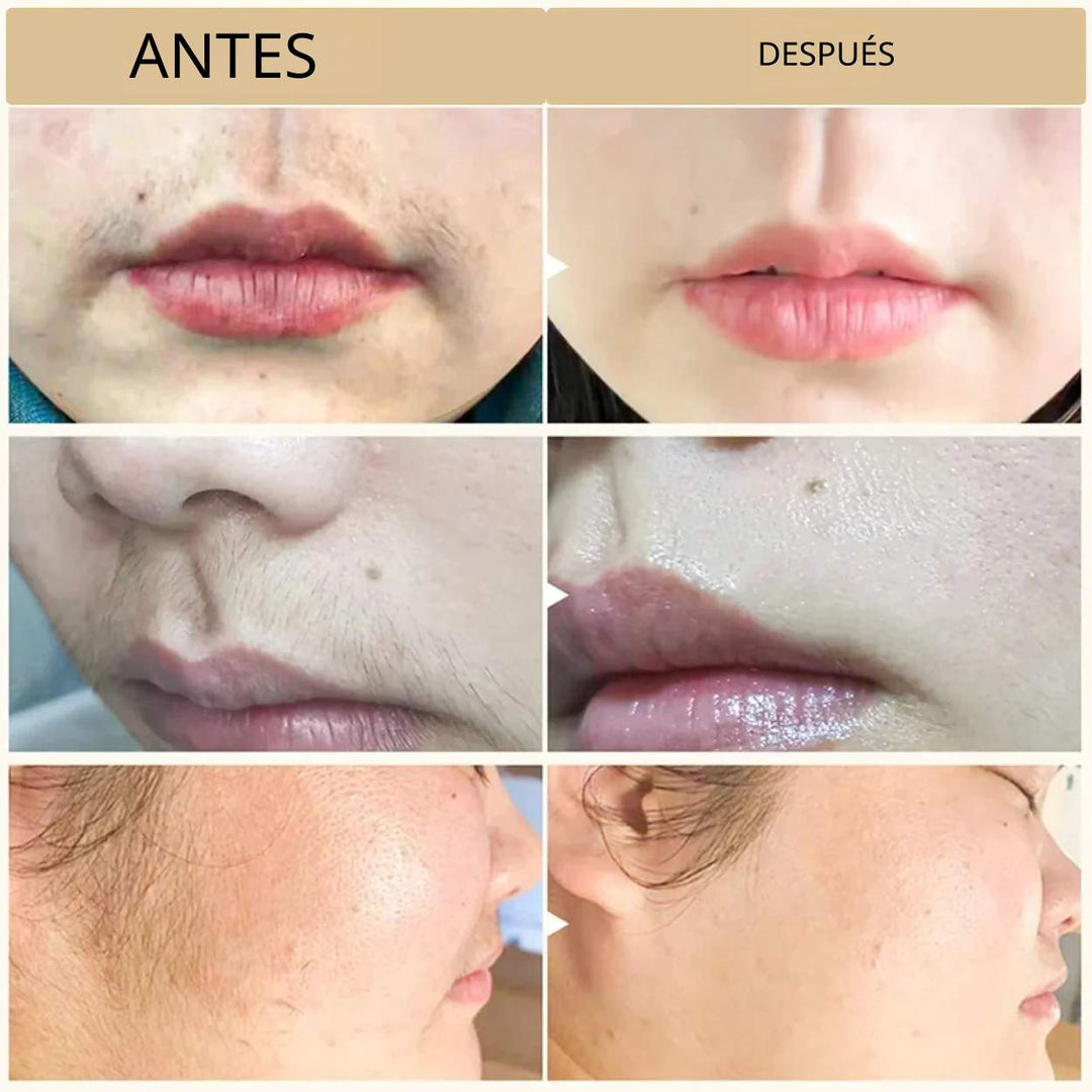 PureEase™ | Crema depilatoria suave y sin dolor