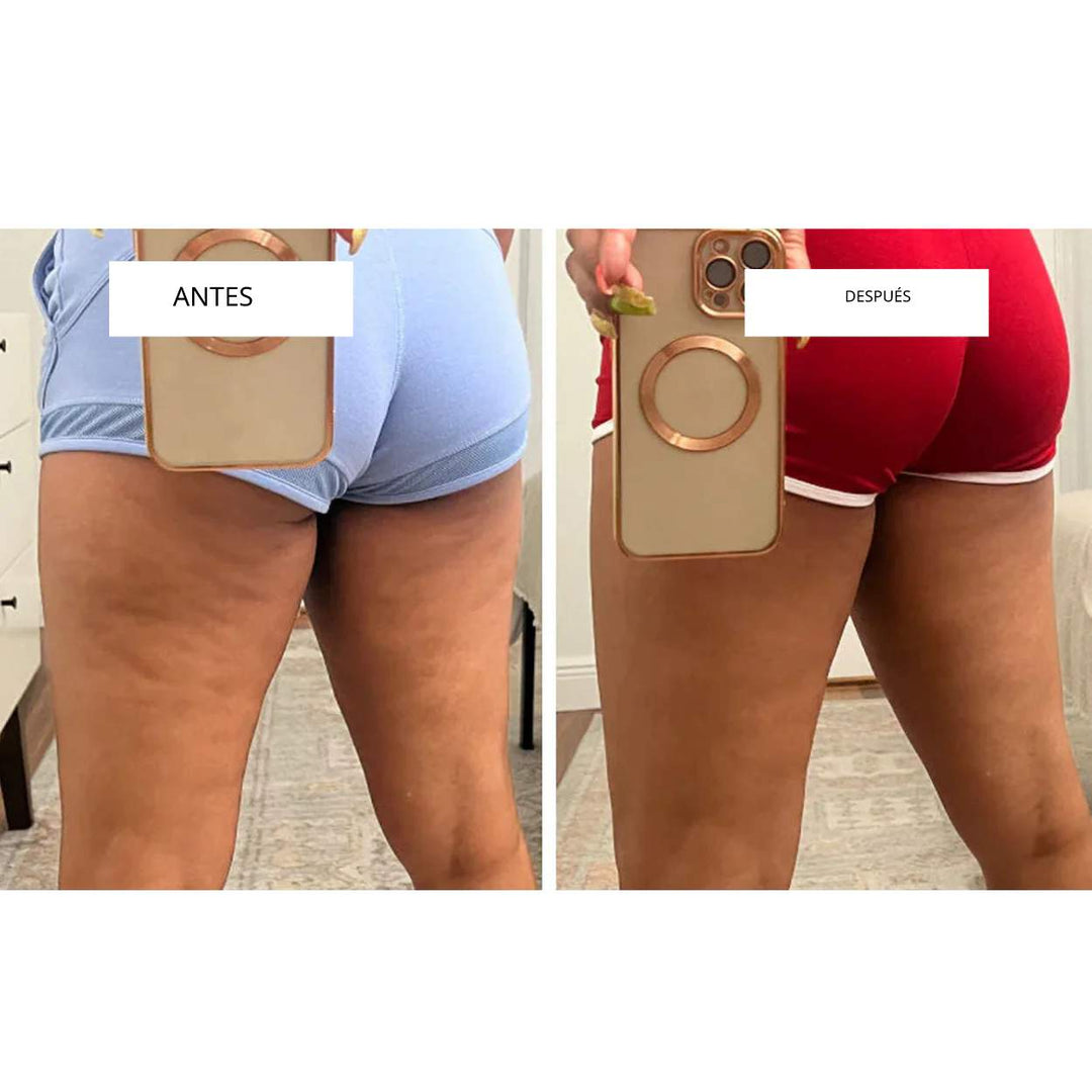 CelluLift™ | Tonifica tu piel con el masajeador de vacío anticelulitis
