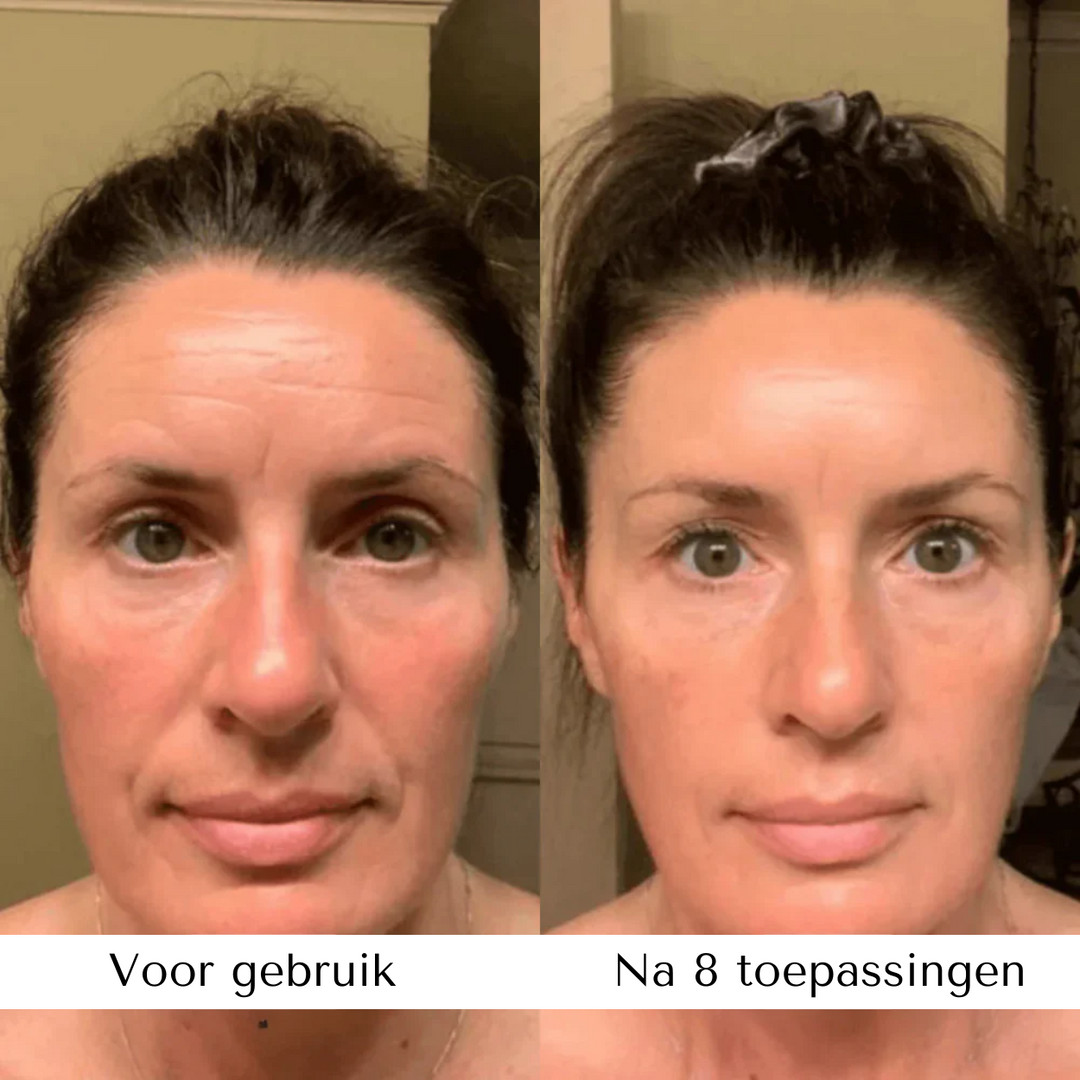 Mangalo Mascarilla de Colágeno Bio ™
