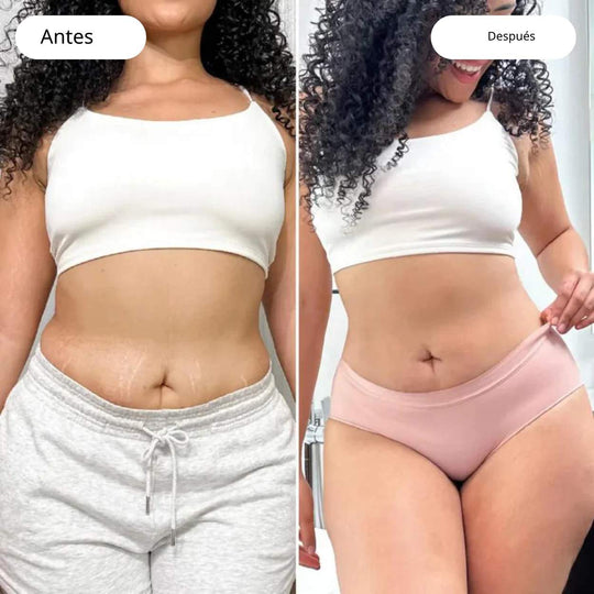 VacuGlow™ | Solución definitiva para la celulitis para un cuerpo impecable